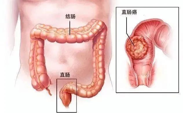 微信图片_20250320145048.jpg 微信图片_20250320145048.jpg
